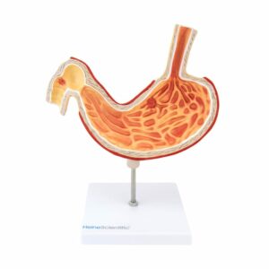 STOMACH MODEL WITH ULCERS
