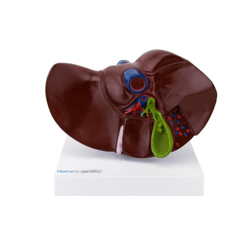 LIVER MODEL WITH GALL STONES