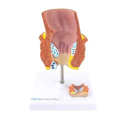 1 21505 01 heinescientific haemorrhoiden modell 600x600