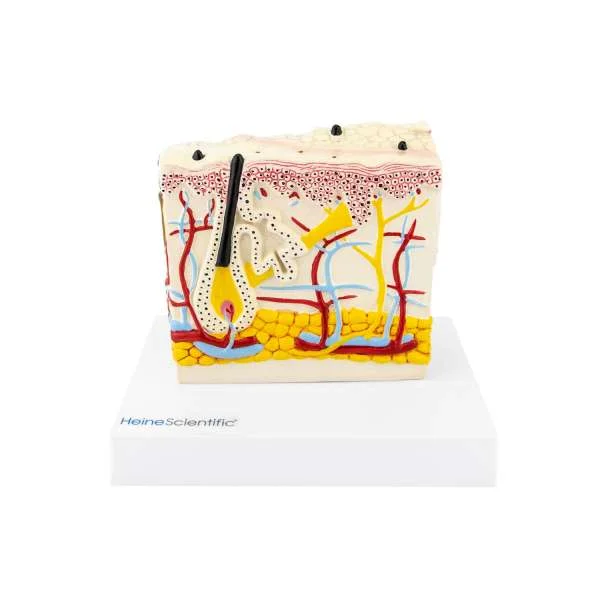 1 21509 01 heinescientific hautmodell psoriasis 600x600